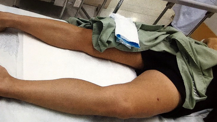Woman shot in leg at Phuket market