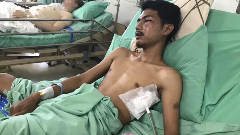 New Year beach sing-along ends with jealous stab in the neck, beating