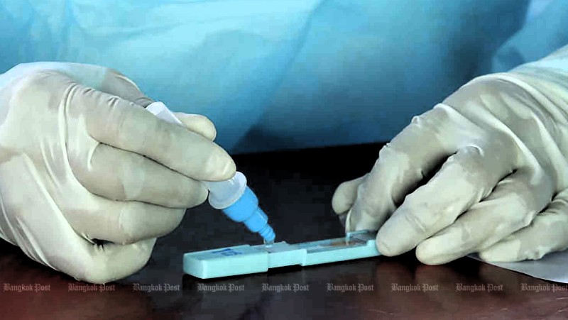 Virus test kits have limitations, says dept