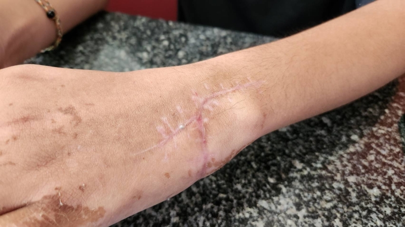 Woman alleges police complicit in failing to arrest perpetrator in Phuket Town knife attack