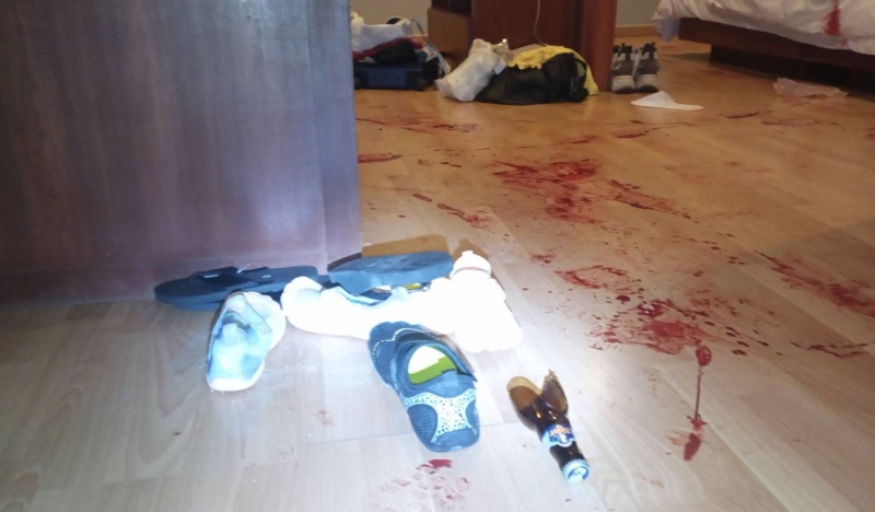 Chinese teen gashes own leg with broken beer bottle